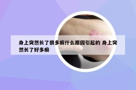 身上突然長了很多癬什么原因引起的 身上突然長了好多癬