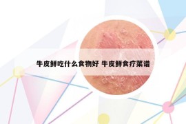 牛皮鮮吃什么食物好 牛皮鮮食療菜譜