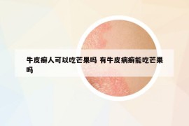 牛皮癬人可以吃芒果嗎 有牛皮病癬能吃芒果嗎