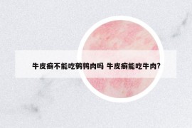 牛皮癬不能吃鵪鶉肉嗎 牛皮癬能吃牛肉?