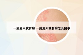 一到夏天就有癬 一到夏天就有癬怎么回事