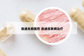南通皮癬醫(yī)院 南通皮膚病治療