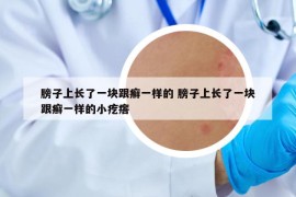 膀子上長了一塊跟癬一樣的 膀子上長了一塊跟癬一樣的小疙瘩