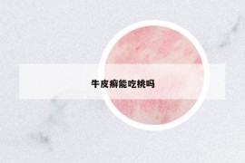 牛皮癬能吃桃嗎