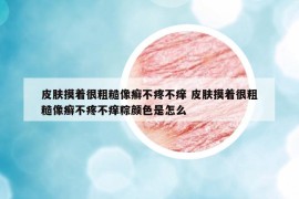 皮膚摸著很粗糙像癬不疼不癢 皮膚摸著很粗糙像癬不疼不癢粽顏色是怎么