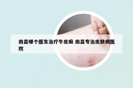 南昌哪個醫(yī)生治療牛皮癬 南昌專治皮膚病醫(yī)院