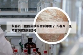 長春八一醫(yī)院皮膚科搬到哪里了 長春八一醫(yī)院官網(wǎng)皮膚科掛號