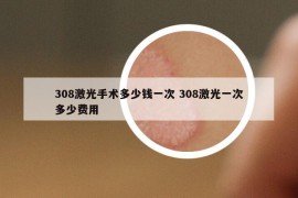 308激光手術(shù)多少錢一次 308激光一次多少費(fèi)用