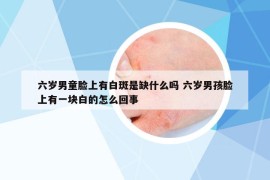 六歲男童臉上有白斑是缺什么嗎 六歲男孩臉上有一塊白的怎么回事