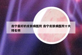 南寧最好的皮膚病醫(yī)院 南寧皮膚病醫(yī)院十大排名榜