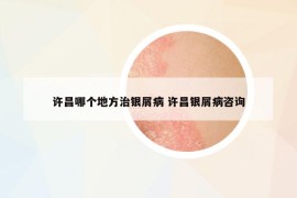 許昌哪個(gè)地方治銀屑病 許昌銀屑病咨詢
