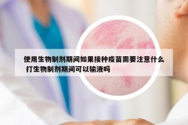 使用生物制劑期間如果接種疫苗需要注意什么 打生物制劑期間可以輸液嗎