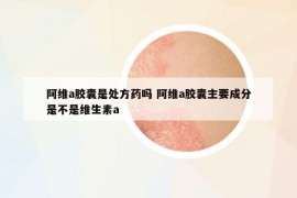 阿維a膠囊是處方藥嗎 阿維a膠囊主要成分是不是維生素a