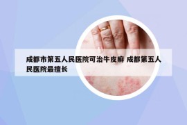 成都市第五人民醫(yī)院可治牛皮癬 成都第五人民醫(yī)院最擅長