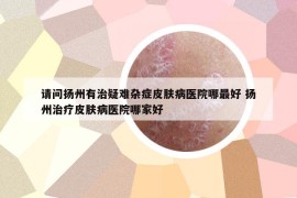 請問揚州有治疑難雜癥皮膚病醫(yī)院哪最好 揚州治療皮膚病醫(yī)院哪家好