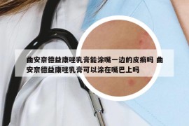曲安奈德益康唑乳膏能涂嘴一邊的皮癬嗎 曲安奈德益康唑乳膏可以涂在嘴巴上嗎