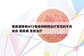 銀屑病使用MTX免疫抑制劑治療常見的不良反應(yīng) 銀屑病 免疫治療
