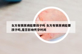 女方有銀屑病能要孩子嗎 女方有銀屑病能要孩子嗎,是否影響懷孕時(shí)間