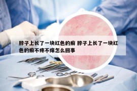 脖子上長了一塊紅色的癬 脖子上長了一塊紅色的癬不疼不癢怎么回事