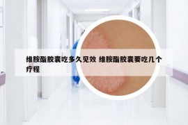 維胺酯膠囊吃多久見效 維胺酯膠囊要吃幾個療程