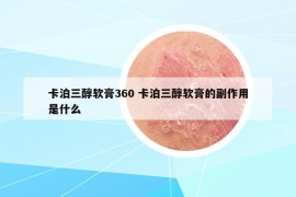 卡泊三醇軟膏360 卡泊三醇軟膏的副作用是什么