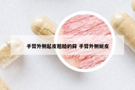 手臂外側(cè)起皮粗糙的蘚 手臂外側(cè)蛻皮