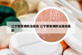 遼寧銀屑病防治指南 遼寧銀屑病防治指南最新