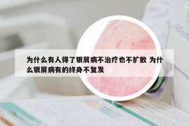 為什么有人得了銀屑病不治療也不擴(kuò)散 為什么銀屑病有的終身不復(fù)發(fā)