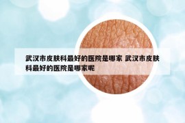武漢市皮膚科最好的醫(yī)院是哪家 武漢市皮膚科最好的醫(yī)院是哪家呢