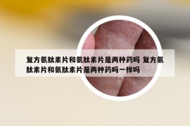 復(fù)方氨肽素片和氨肽素片是兩種藥嗎 復(fù)方氨肽素片和氨肽素片是兩種藥嗎一樣嗎
