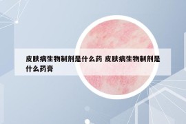 皮膚病生物制劑是什么藥 皮膚病生物制劑是什么藥膏