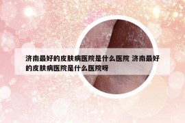 濟(jì)南最好的皮膚病醫(yī)院是什么醫(yī)院 濟(jì)南最好的皮膚病醫(yī)院是什么醫(yī)院呀