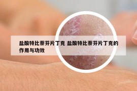 鹽酸特比萘芬片丁克 鹽酸特比萘芬片丁克的作用與功效