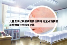 兒童點滴狀銀屑病需要住院嗎 兒童點滴狀銀屑病需要住院嗎多少錢
