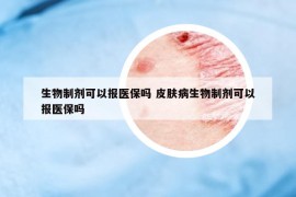 生物制劑可以報(bào)醫(yī)保嗎 皮膚病生物制劑可以報(bào)醫(yī)保嗎