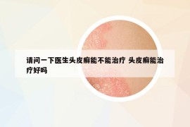 請(qǐng)問(wèn)一下醫(yī)生頭皮癬能不能治療 頭皮癬能治療好嗎