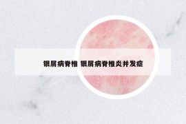 銀屑病脊椎 銀屑病脊椎炎并發(fā)癥