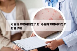 可善挺生物制劑怎么打 可善挺生物制劑怎么打肚子哪