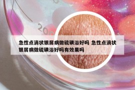 急性點(diǎn)滴狀銀屑病做硫磺浴好嗎 急性點(diǎn)滴狀銀屑病做硫磺浴好嗎有效果嗎