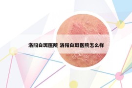 洛陽白斑醫(yī)院 洛陽白斑醫(yī)院怎么樣