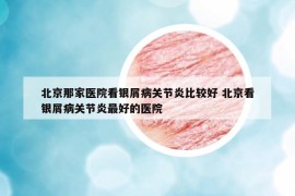 北京那家醫(yī)院看銀屑病關(guān)節(jié)炎比較好 北京看銀屑病關(guān)節(jié)炎最好的醫(yī)院