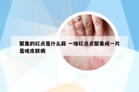 聚集的紅點(diǎn)是什么蘚 一堆紅點(diǎn)點(diǎn)聚集成一片是啥皮膚病