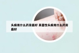 頭癬用什么藥膏最好 真菌性頭癬用什么藥膏最好