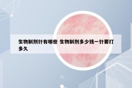 生物制劑針有哪些 生物制劑多少錢一針要打多久
