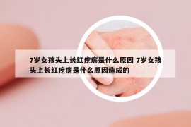7歲女孩頭上長紅疙瘩是什么原因 7歲女孩頭上長紅疙瘩是什么原因造成的