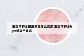 形態(tài)學(xué)符合銀屑病是什么意思 形態(tài)學(xué)符合hpv感染嚴(yán)重嗎