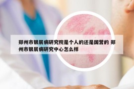 鄭州市銀屑病研究院是個人的還是國營的 鄭州市銀屑病研究中心怎么樣