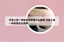 手背上有一塊白色皮膚是什么原因 手背上有一塊白斑怎么回事