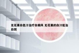 無花果白色汁治療白癜風(fēng) 無花果的白汁能治白斑