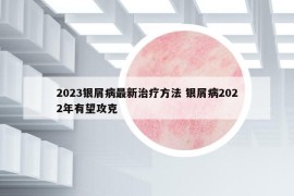 2023銀屑病最新治療方法 銀屑病2022年有望攻克